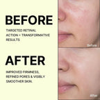 Celimax Retinal Anti-Aging Face Serum
